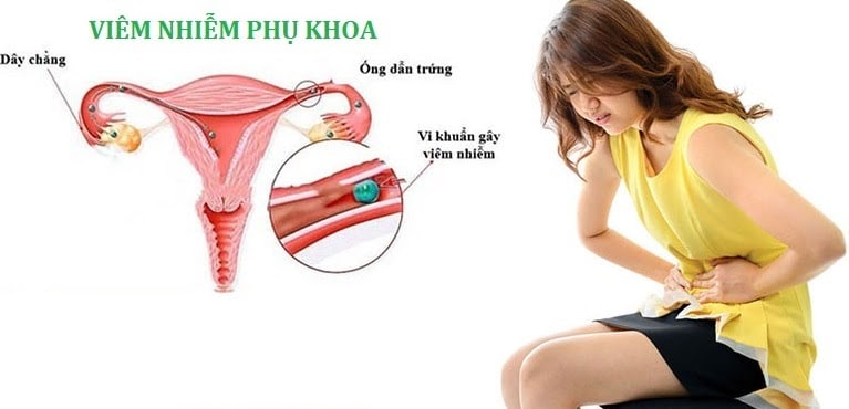 Bệnh viêm phụ khoa có nhiều nguyên nhân khác nhau.