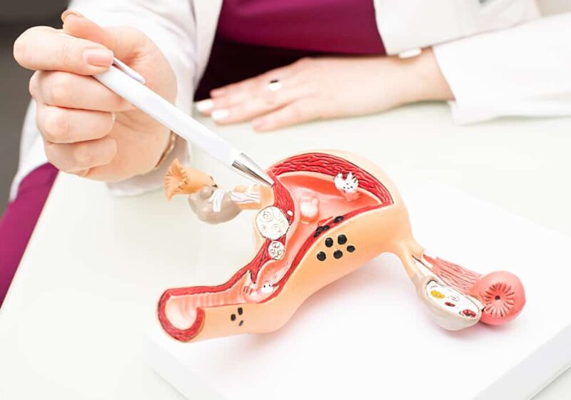 Bạn nên biết những gì trước khi thực hiện cắt bỏ tử cung qua đường mở bụng?