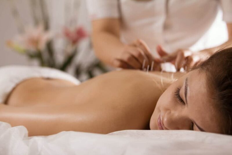 Châm cứu/massage – cách kéo dài tuổi hồi xuân của phụ nữ